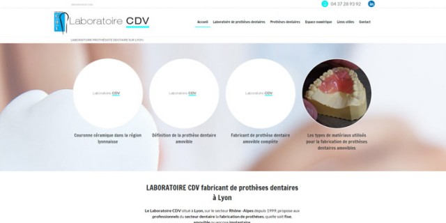 Commande de prothèse dentaire pour spécialiste de la santé sur Lyon - Laboratoire CDV