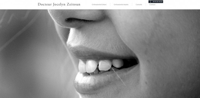 Traitements orthodontiques pour adultes à Marseille - Docteur Zeitoun