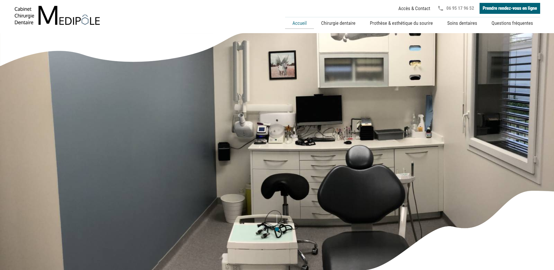 Où trouver un dentiste spécialisé dans la pose d'une prothèse dentaire Inlay Onlay à Villeurbanne ? 