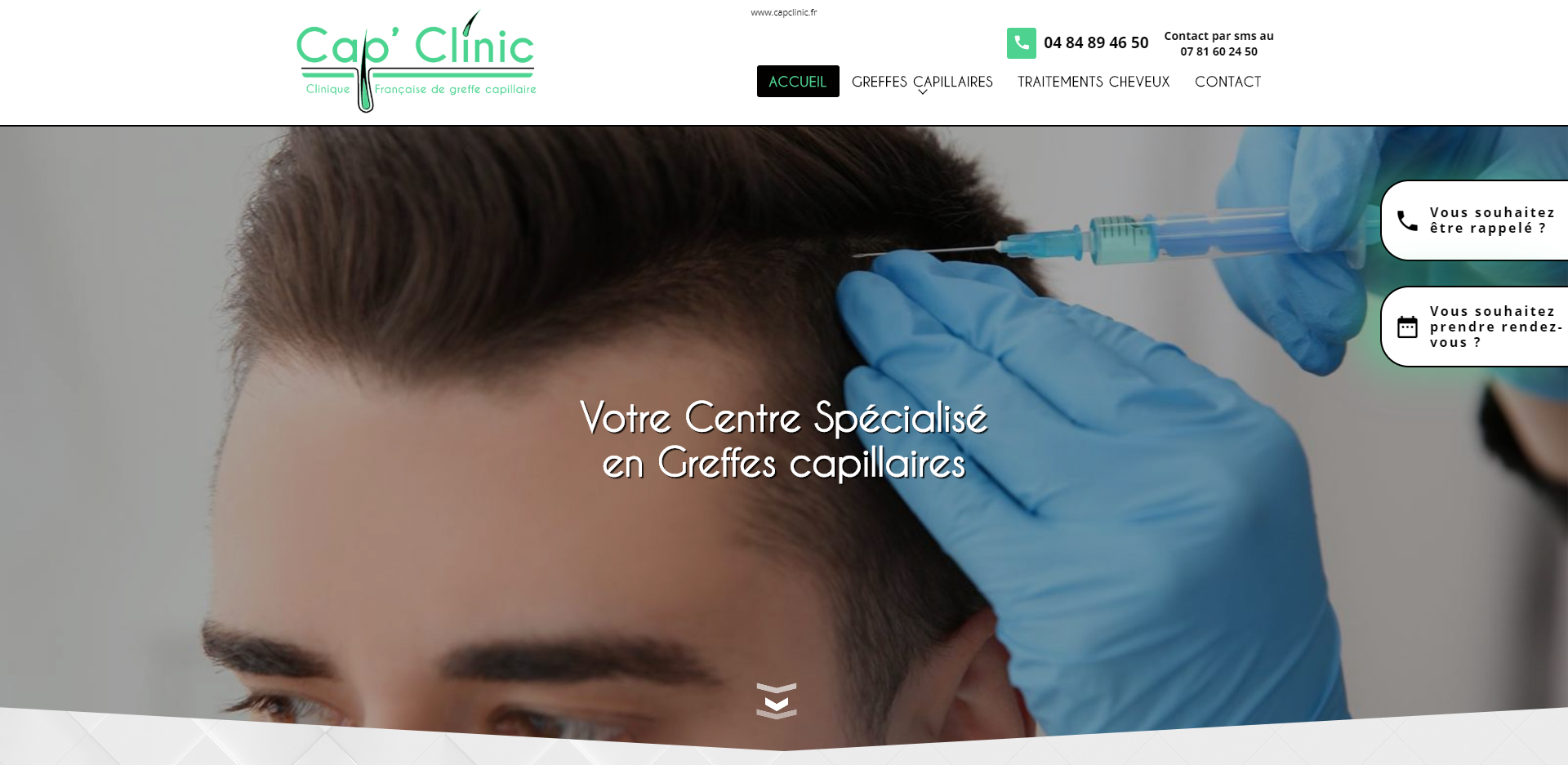 Où se faire poser des implants capillaire et une greffe de cheveux à Marseille ?