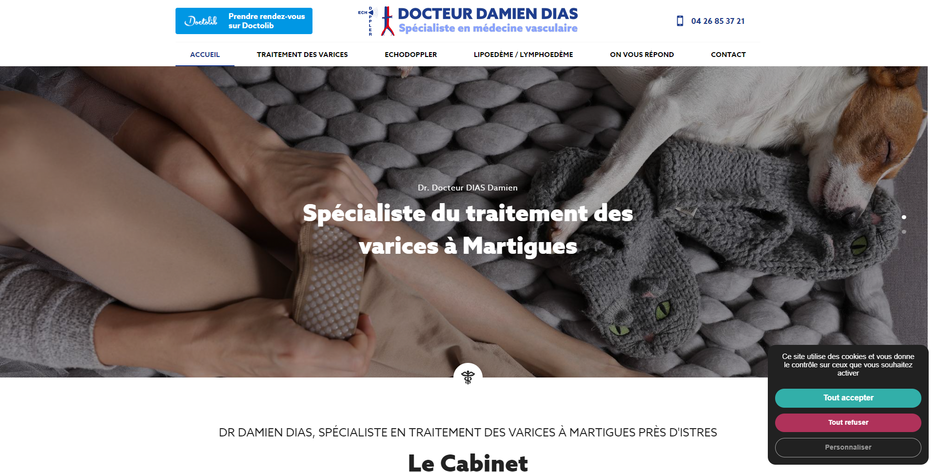Traitement des varices à Martigues près d'Istres et Marseille 