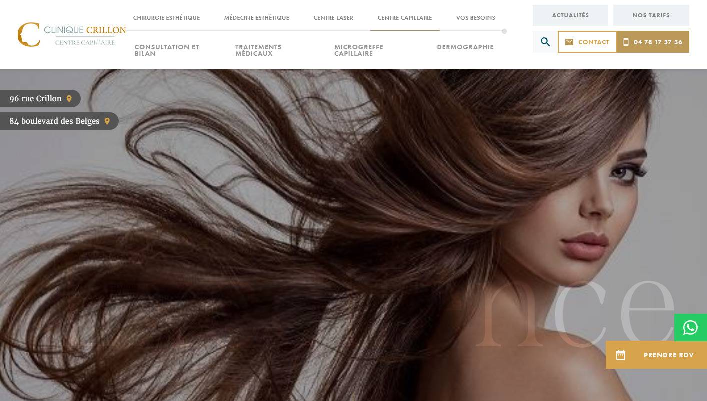 Quelle clinique à Lyon pour une greffe de cheveux ? - Clinique Crillon