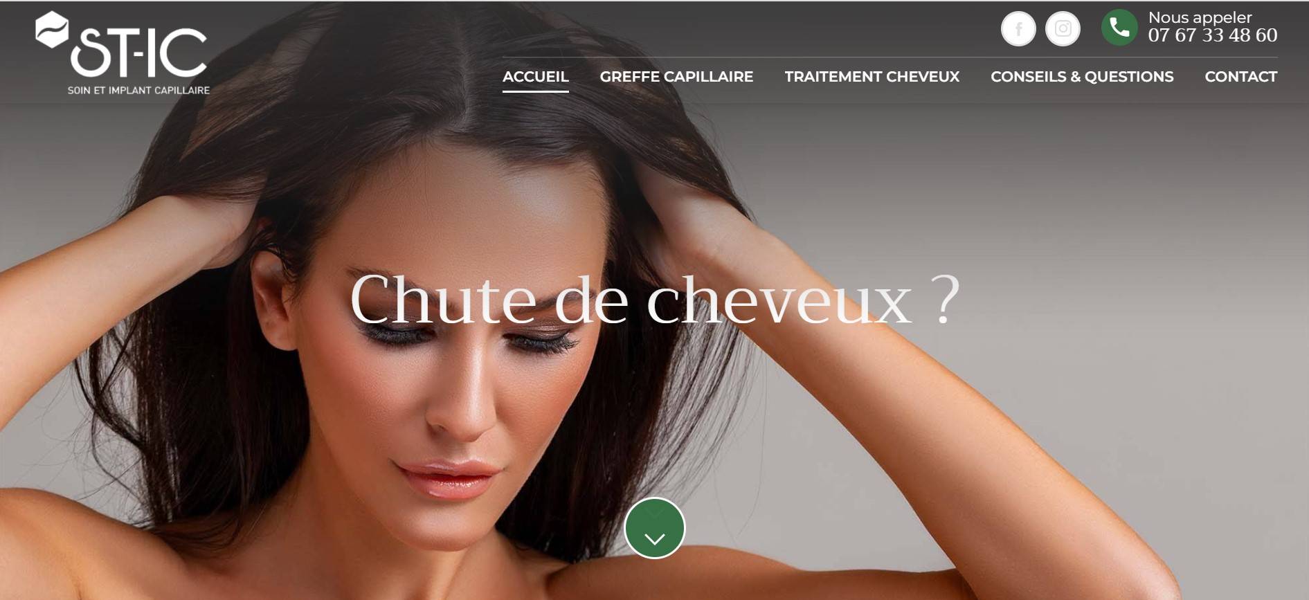 Greffe de cheveux avec de bons avis à Marseille 