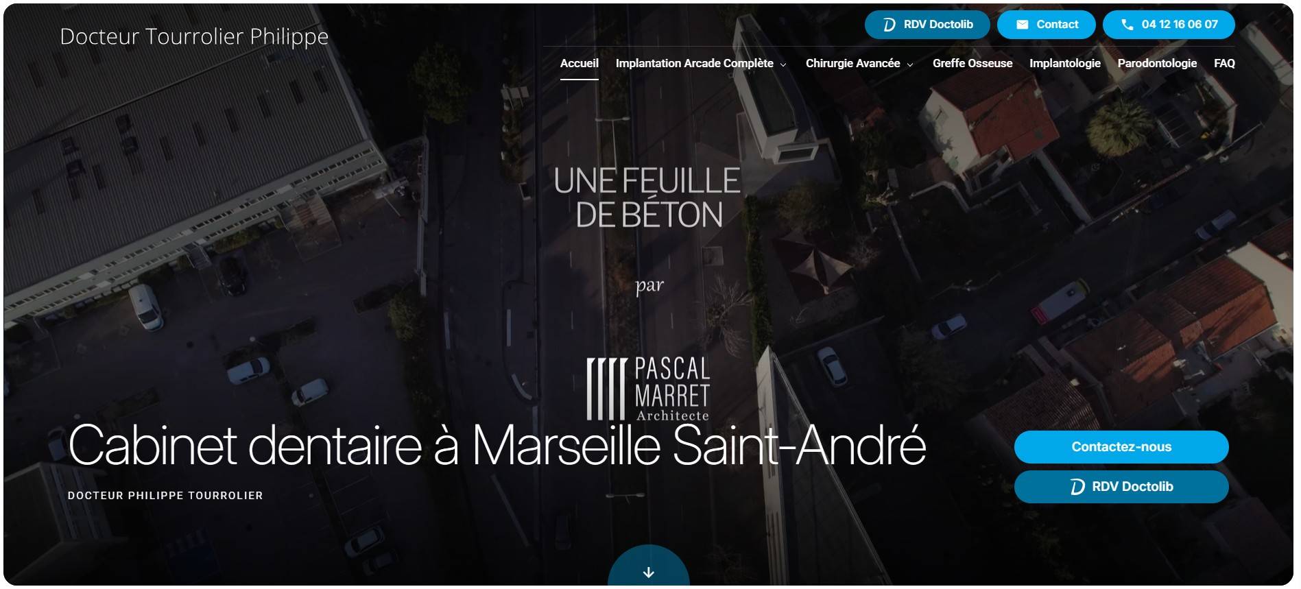 Où faire poser des gouttières Invisalign sur Marseille ? Docteur Tourrolier Philippe