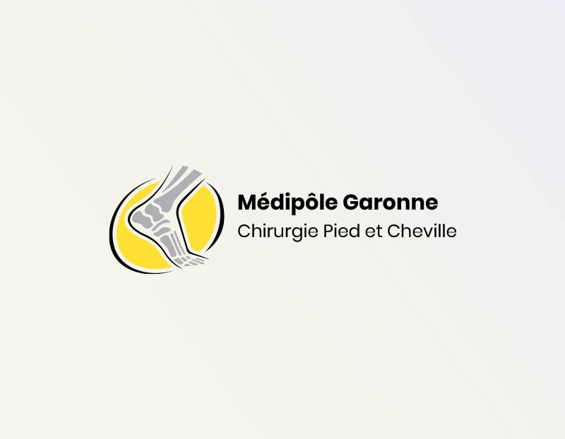 Quelle clinique choisir pour se faire opérer d'un hallux valgus ou d'un oignon au pied à Toulouse ? Médipôle Garonne
