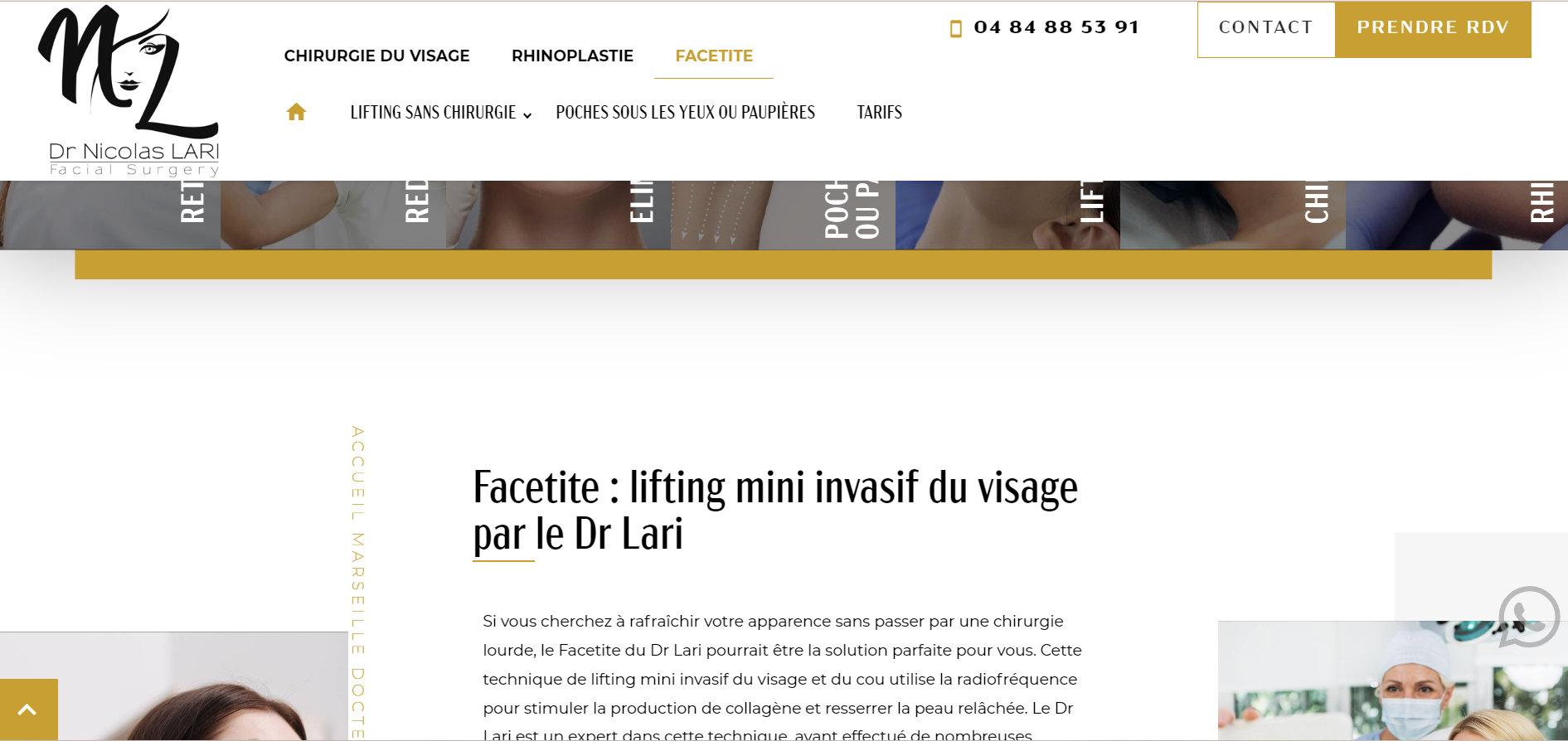 prix facetite marseille 