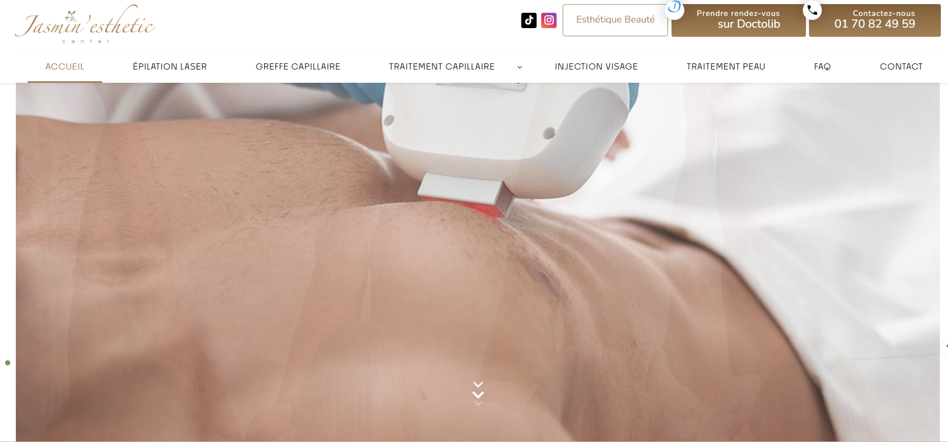 Faire blanchiment dentaire pour sourire extra white à Créteil - Jasmin’esthetic